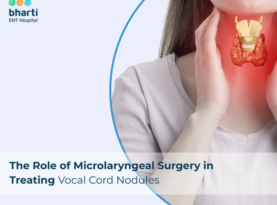 The Role of Microlaryngeal Surgery in Treating Vocal Cord Nodules