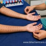 what is an allergy skin prick test