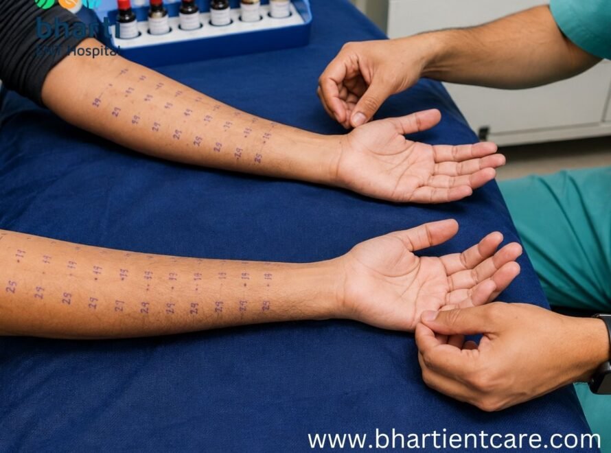 what is an allergy skin prick test