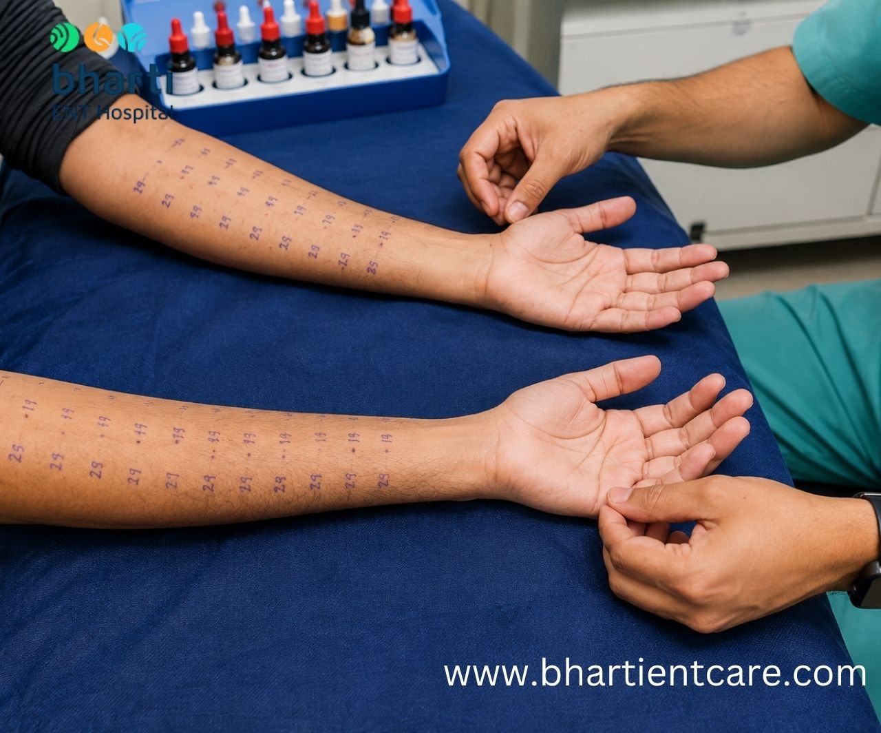 what is an allergy skin prick test
